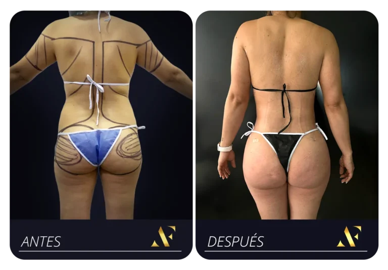 Mesa de trabajo 5 copia 2