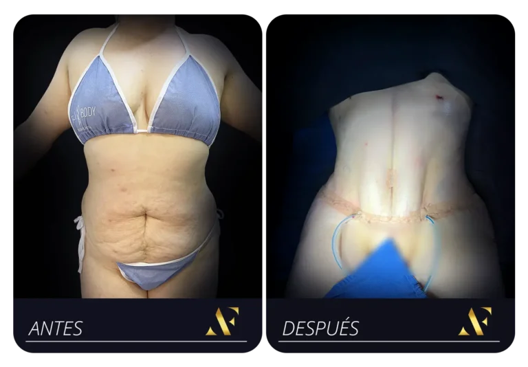 Mesa de trabajo 5 copia 3