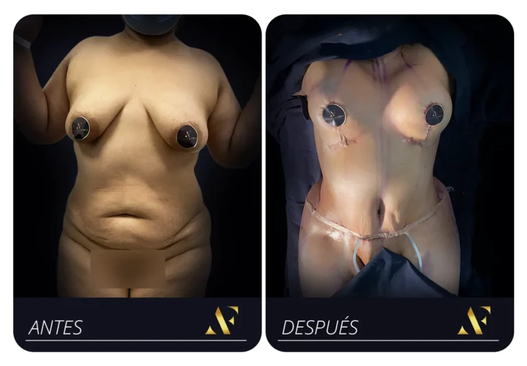 Mesa de trabajo 5 copia